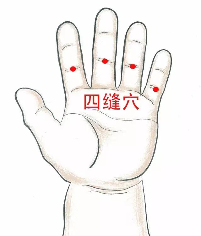 小儿积食发烧如何推拿,小儿推拿按摩积食发烧