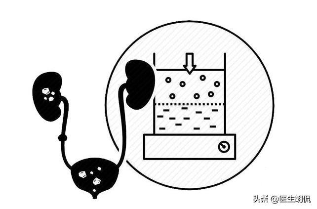 膀胱癌十大恶性肿瘤之一！早起出现4个症状，最好检查下