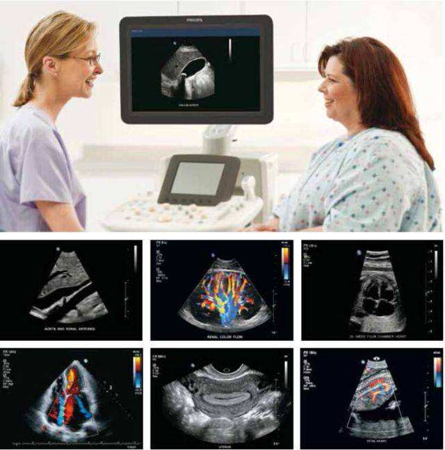 做b超涂的液体没擦干净,做b超涂在身上的东西有害吗