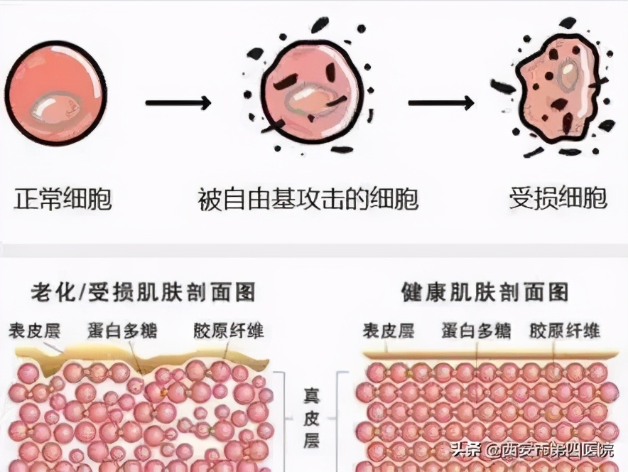 毛孔粗大的正确护肤方法,毛孔粗大正确护肤方法