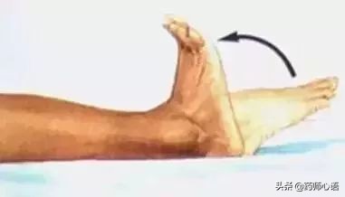 关节积液是不是不能治断根,关节积液如何做到不复发