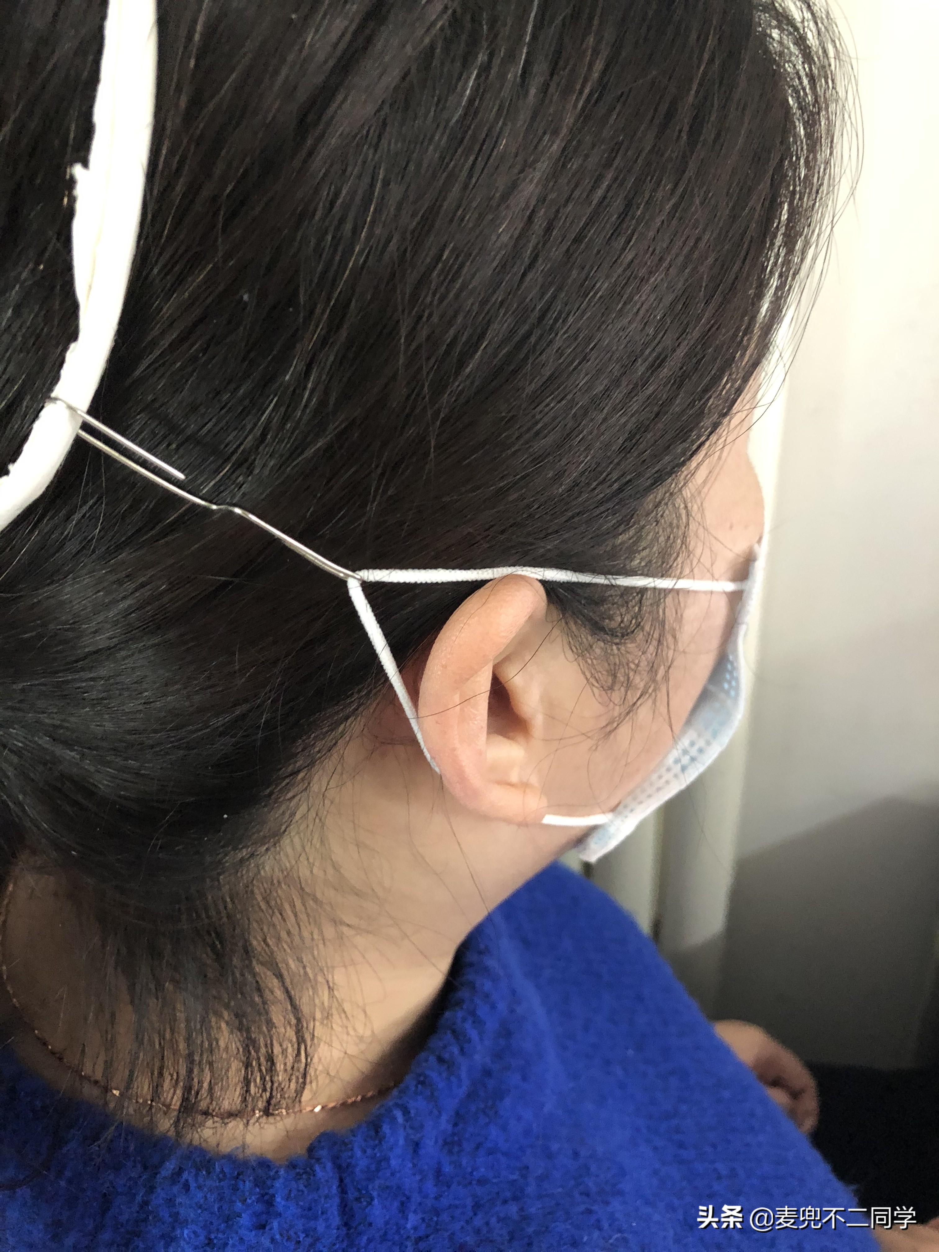 n95口罩戴着耳朵疼解决方法,口罩把耳朵勒烂了怎么办用什么药