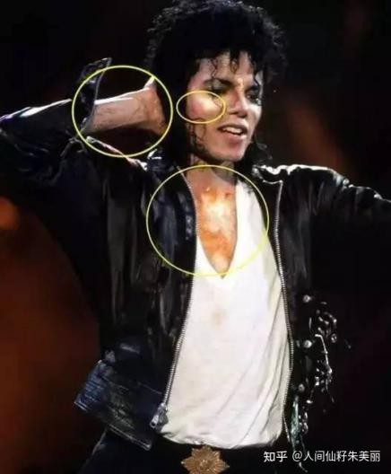 女人脸上有斑吃什么药可以祛斑,脸上长斑吃什么中药调理祛斑