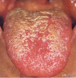 最实用的舌诊图六大舌象,舌诊深入学习书