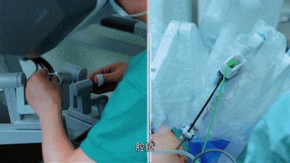 林黛玉重病咳血,林黛玉肺癌