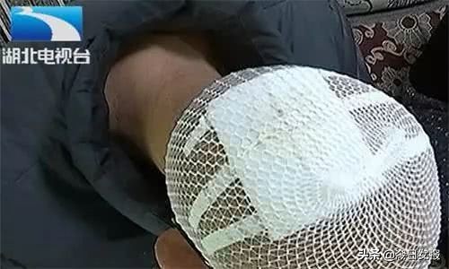 电热水器发生爆炸几率大吗,电热水器爆炸致一家三口重度烧伤