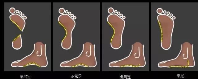 运动鞋你买对了吗,以前买过运动鞋