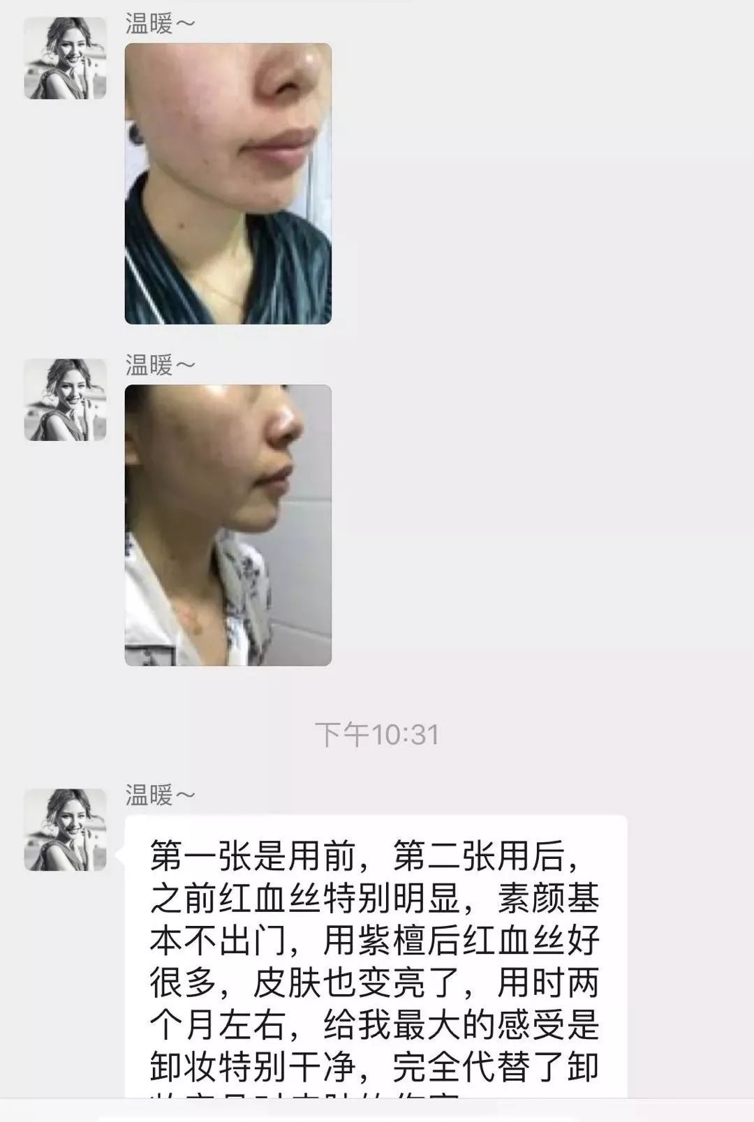 紫檀如何帮助人体抗衰老,紫檀能淡斑吗