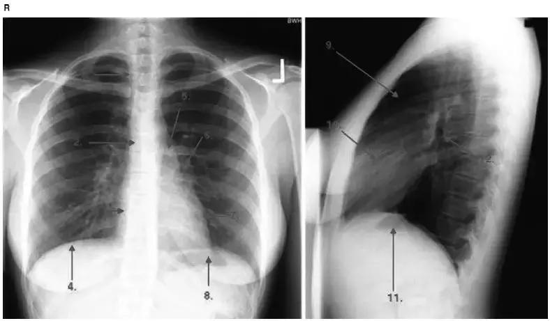 胸部影像解剖图谱书,胸部断层图谱