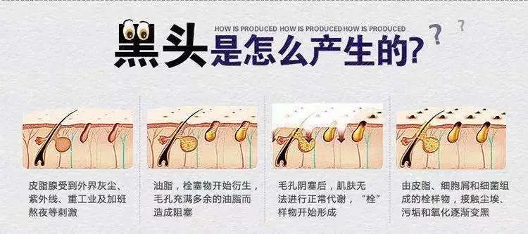 最简单最实用的去黑头方法,简单有效的去黑头方法
