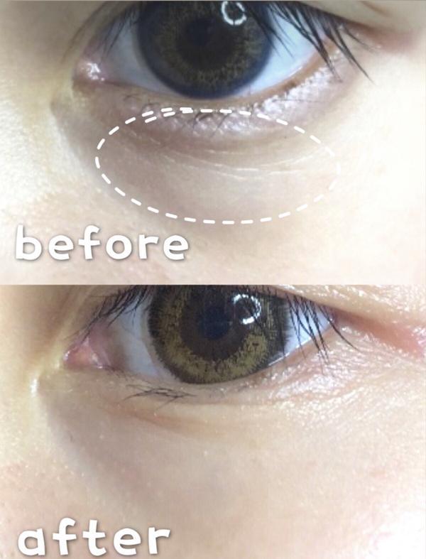 药店有款“便宜”眼霜，快速改善眼袋细纹，后悔没早点用