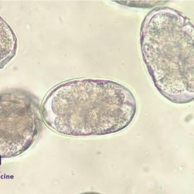 寄生虫的防治知识,寄生虫的防治漫画在线观看