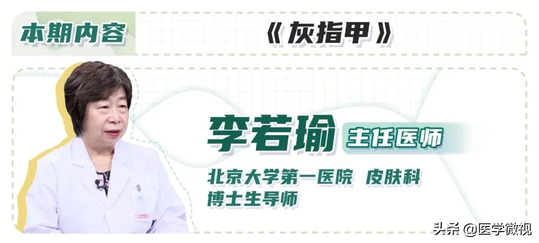 灰指甲治了半年也没治好？可能不是药的问题