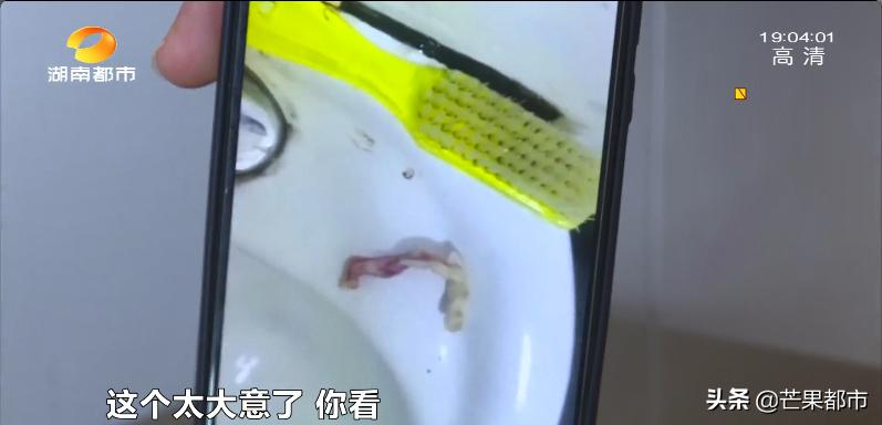 擤鼻涕擤出纱布,擤鼻涕擤出来血块