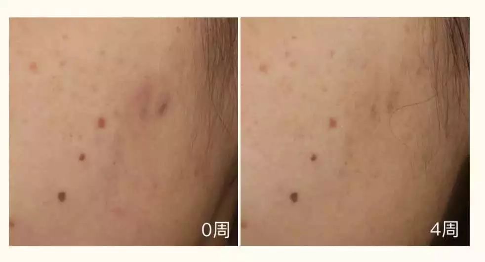 平价护肤品vs贵妇护肤品,平价护肤品和高端化妆品