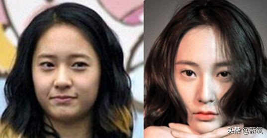 盘点整容后不敢认的女星颜值巅峰,知名女网红被扒整容