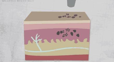 激光祛纹身的正确方法,激光快速祛纹身方法