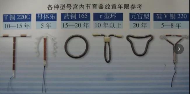 遗留在妈妈体内的节育环,钉在子宫壁上的节育环