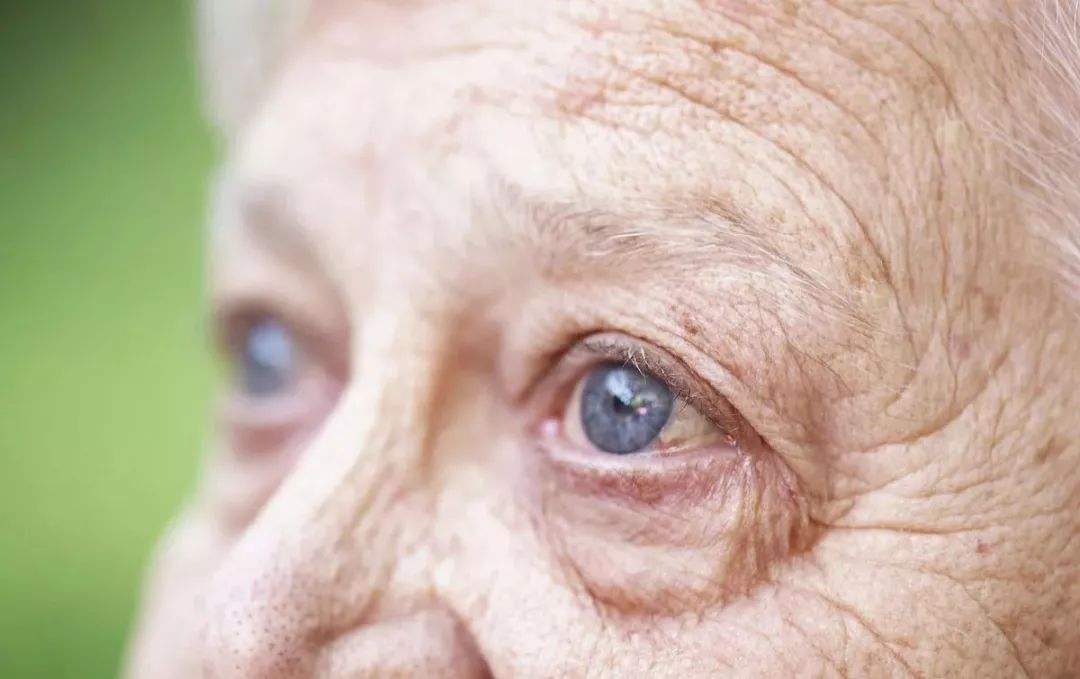 左眼皮跳财右眼跳灾是真的吗,左眼跳财右眼跳灾为什么眼皮会跳