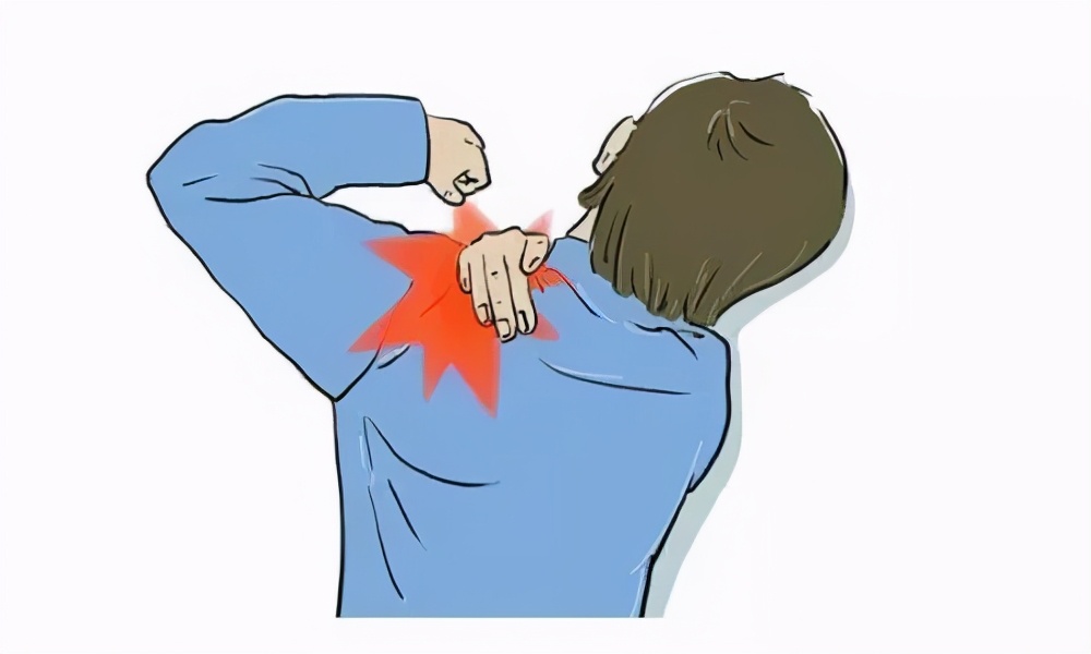 小针刀治疗肩部视频,肩背部小针刀视频