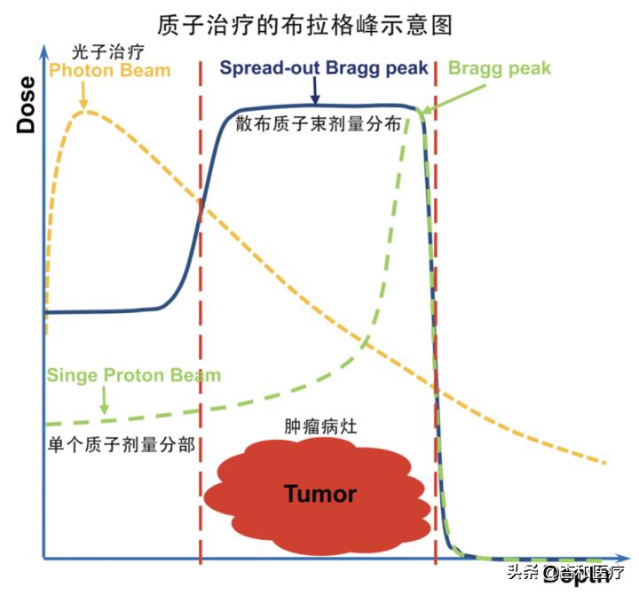 质子治疗适用于什么癌症,网传120万一针的抗癌药是真的吗