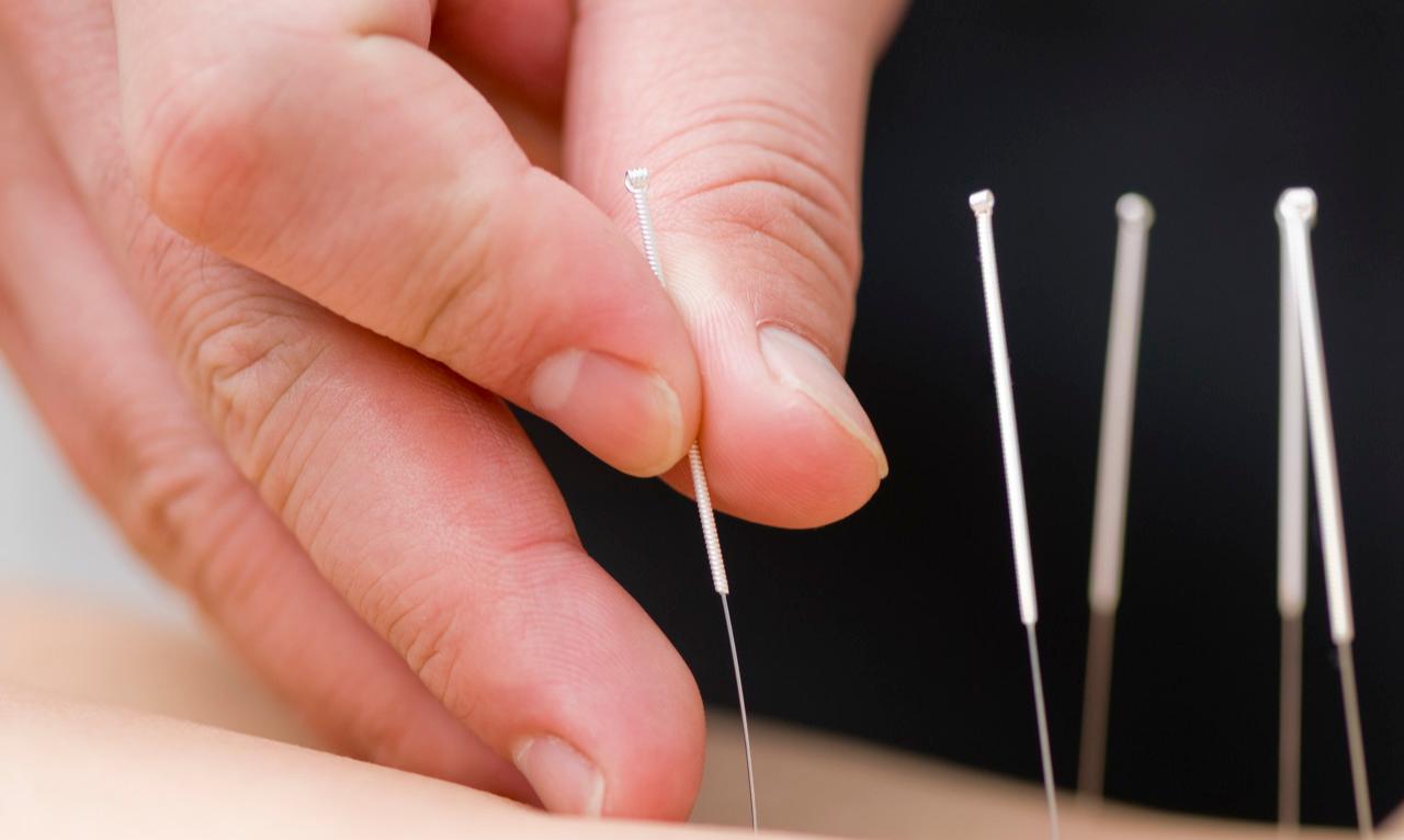 火针治疗膝关节内侧副韧带炎,治疗膝关节骨性关节炎最好的方法