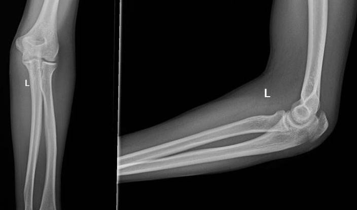 林书豪的伤病,林书豪重返赛场再次负伤