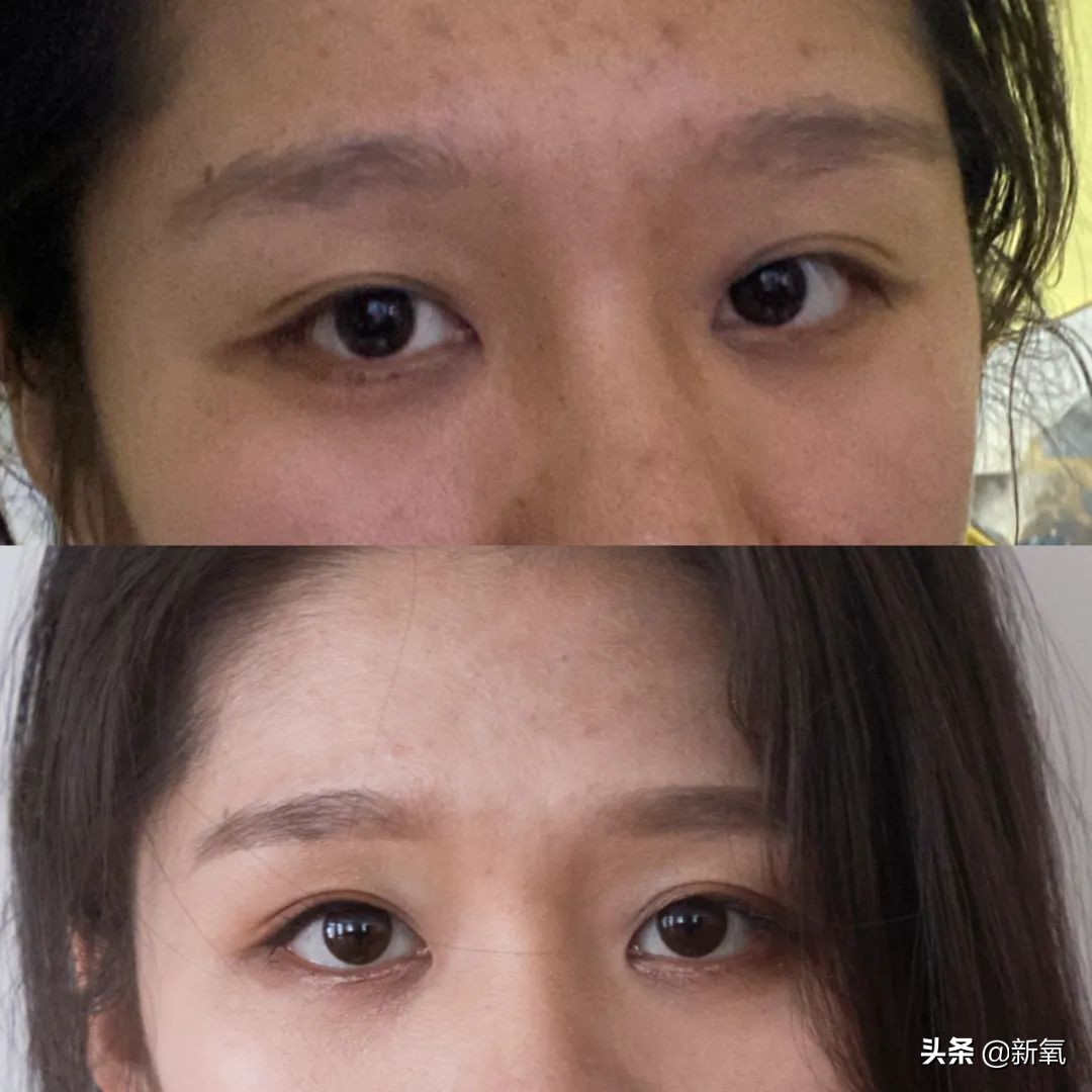 村姑整成鞠婧祎的鼻子变天使,鞠婧祎的鼻子整过吗