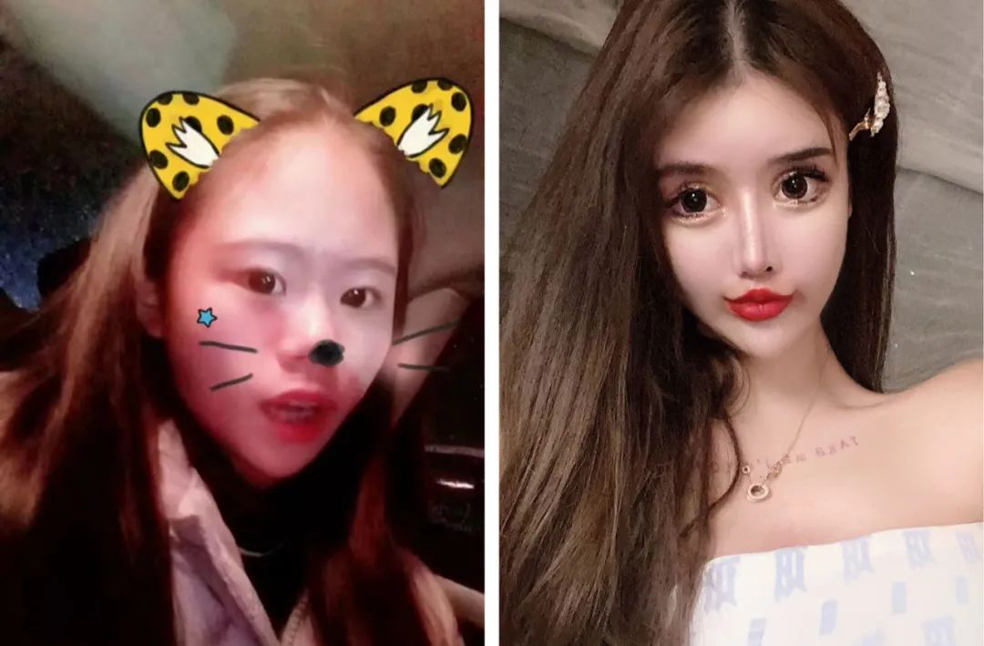 中国整容第一人现状,整容失败中国第一人