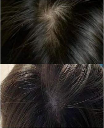 孕期为什么不能用海飞丝洗发水,阿道夫和海飞丝洗发水哪个好用