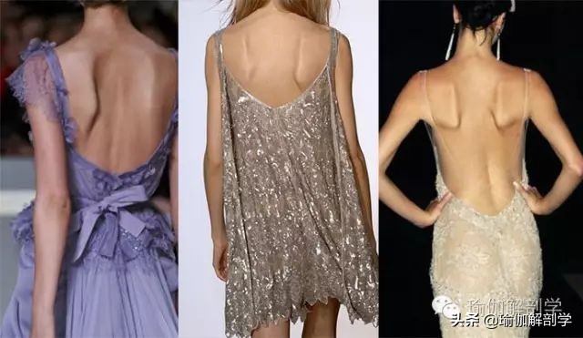 蝴蝶骨中间脊椎有凸起,翼状肩胛为何要加强菱形肌