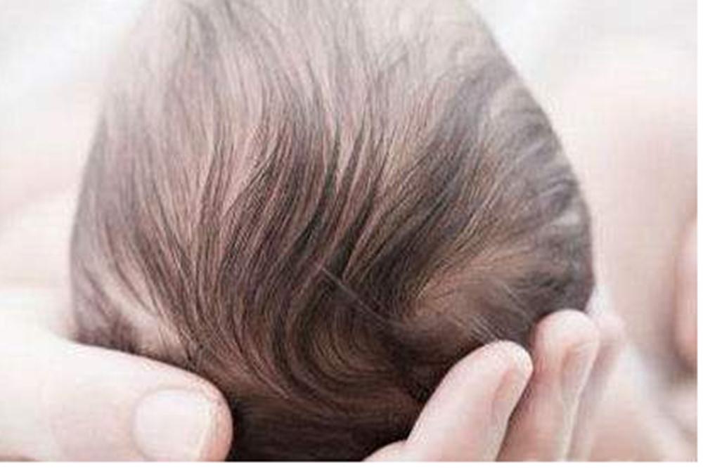 什么发型影响脸型发育的,头型扁又尖怎么矫正