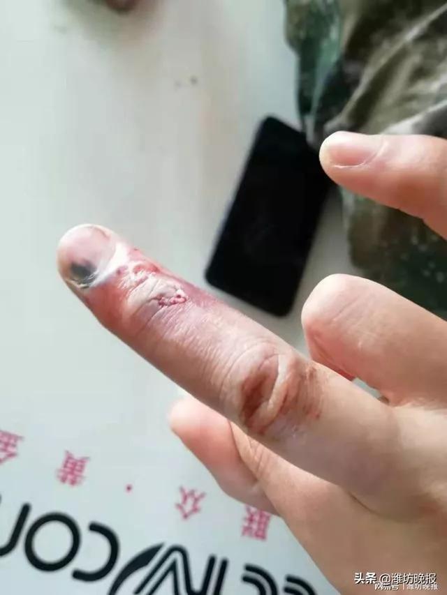 疫情期间你熬住了吗 (如果疫情再下去你能熬多久)