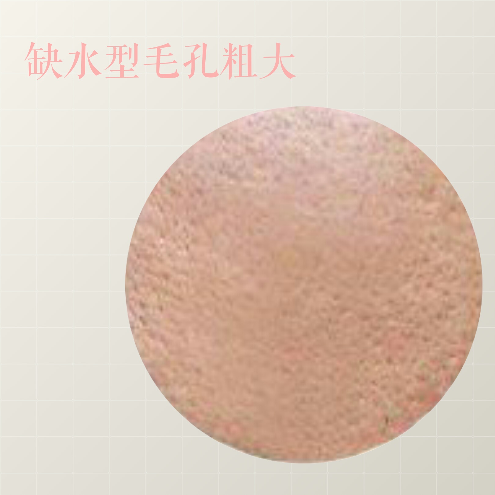 毛孔粗大怎么办给你最全护理指南,目前解决毛孔粗大最有效的手段