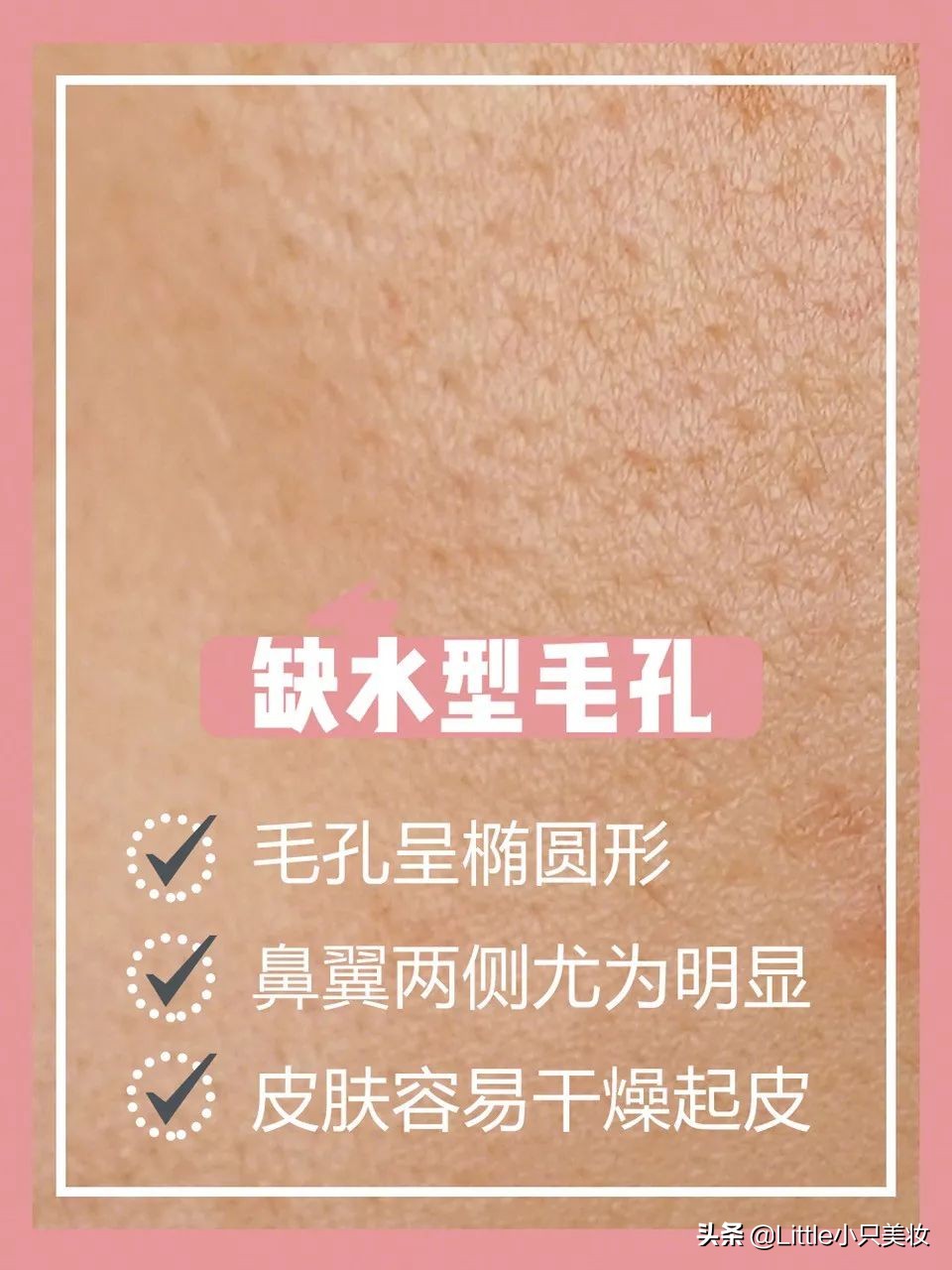 简单几招让你迅速解决粗大毛孔,改善毛孔粗大最有效的办法测评