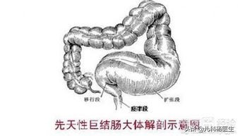 18个月宝宝便秘最快的解决方法,18个月宝宝便秘怎么调理