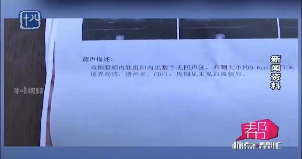 天价打童颜针,女明星打120万的美容针