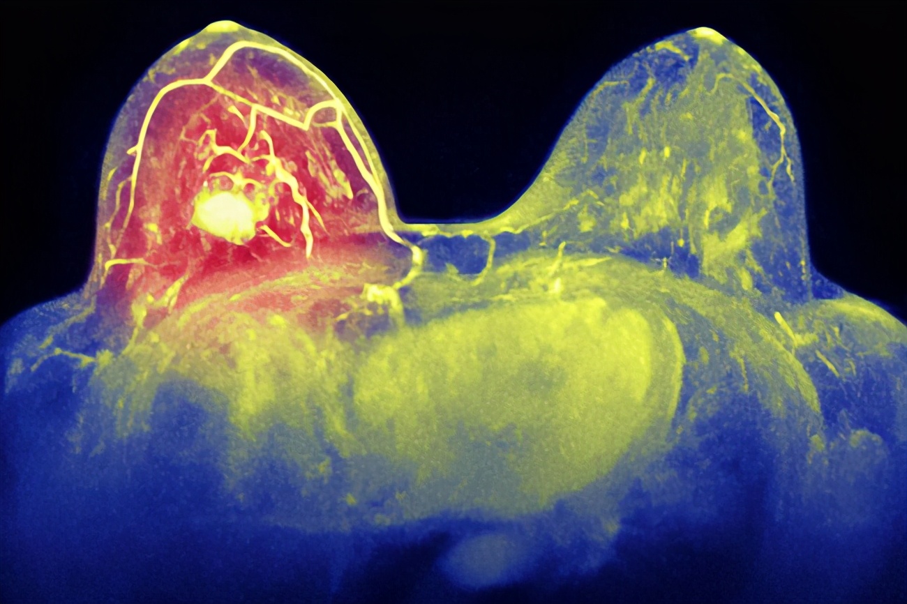 乳头痒是什么原因如何防治,乳腺乳头痒是怎么回事