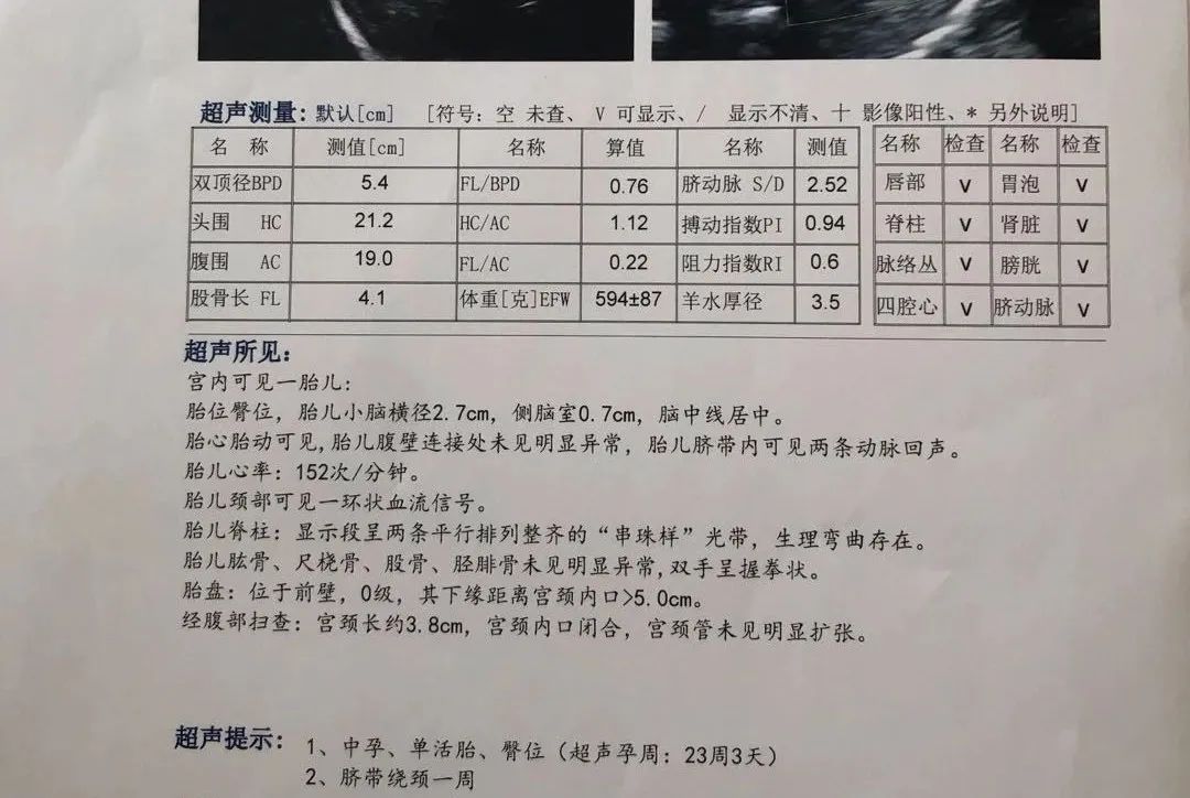 孕期一共做几次b超检查,孕期需要做几次b超检查