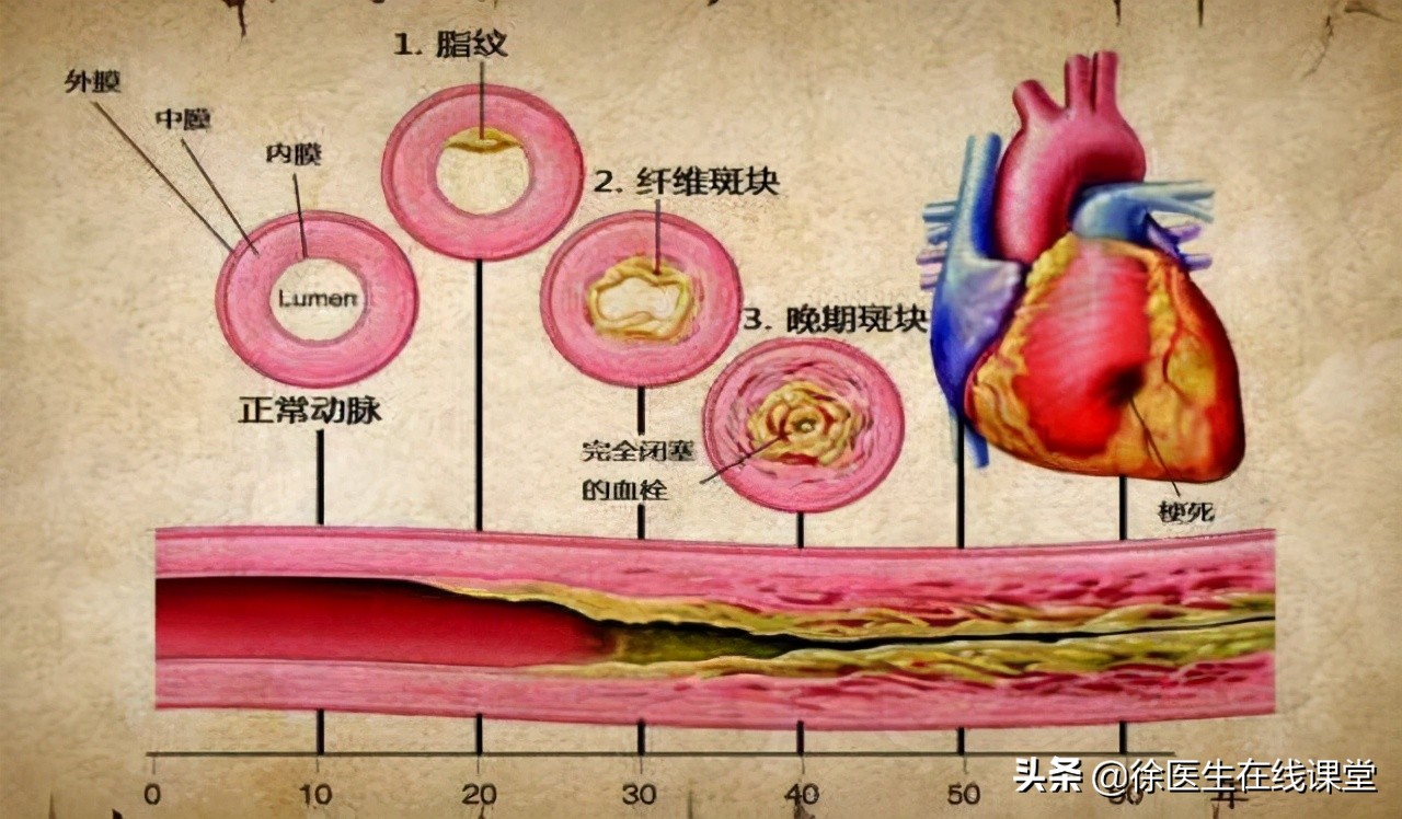 肝硬化消化道出血静脉曲张的治疗,肝硬化静脉曲张出血治疗原则