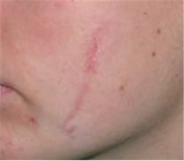 试试、看看、等等,算命式医生害死人:乡镇就医三原则