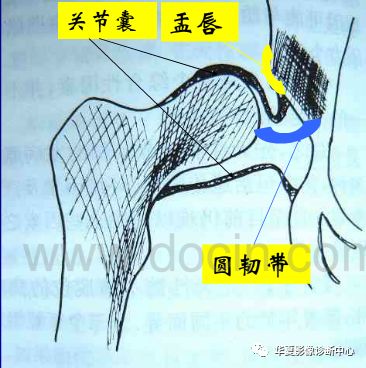 先天性髋关节脱位饮食,先天性髋关节脱位属不属于残疾人