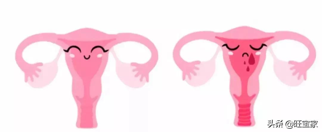 小产坐月子是天方夜谭？小产的这些事儿你必须了解！