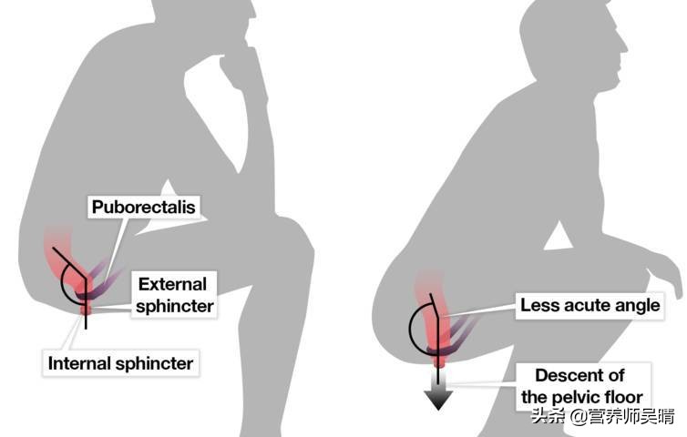 自从开始减肥后总是很渴,自从开始减肥后老是拉肚子