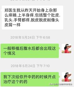 取完卵腹水了移植后还会腹水吗,取完卵后有腹水还能移植吗