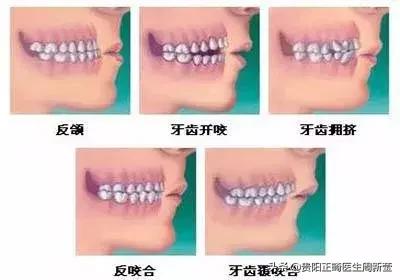 30岁还能牙齿矫正吗效果怎么样,30多岁还能做牙齿矫正