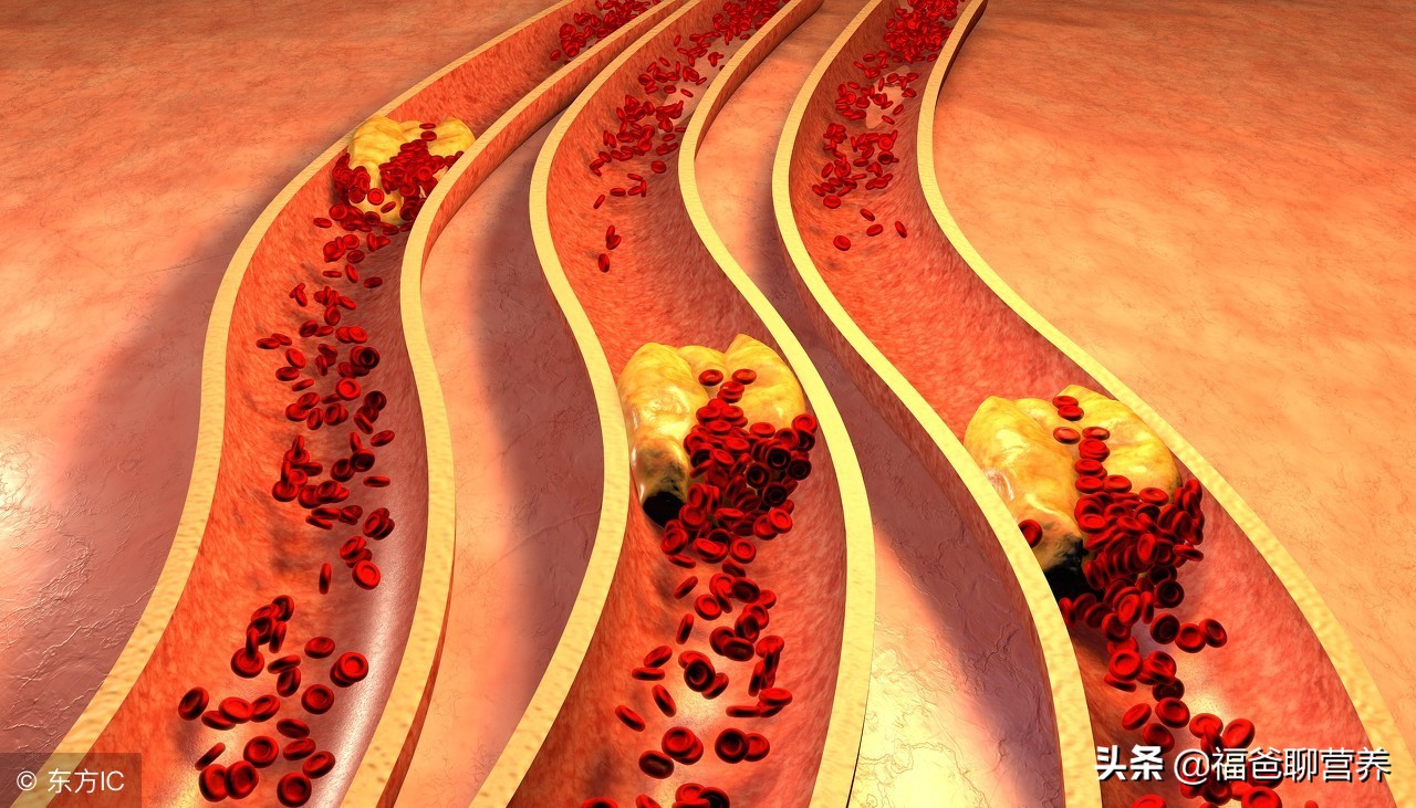 什么中药可以把堵塞的血管通开,有没有疏通血管的药