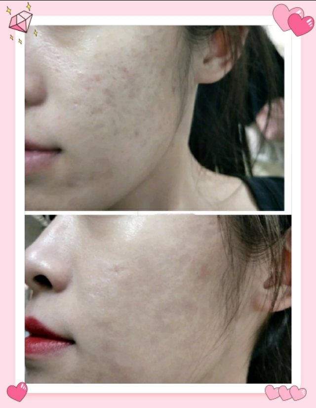 适合干皮大牌粉底液测评视频,适合大干皮瑕疵皮的平价粉底液