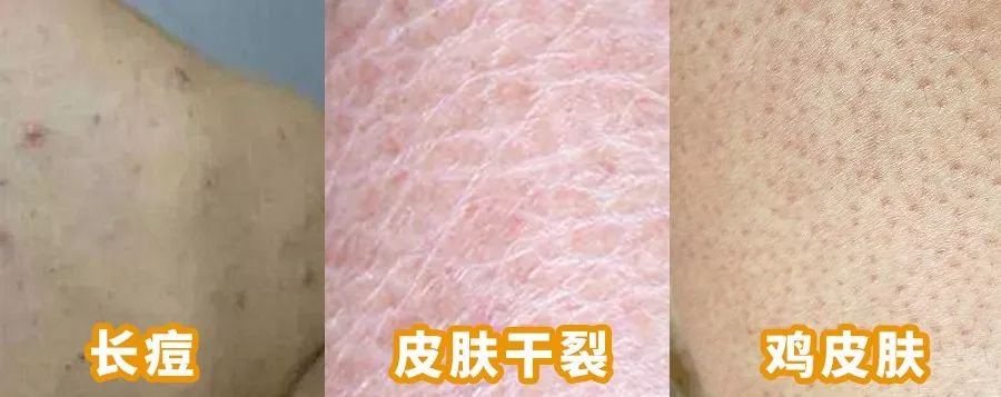 何穗美白淡斑霜,何穗竟比范冰冰还肤白