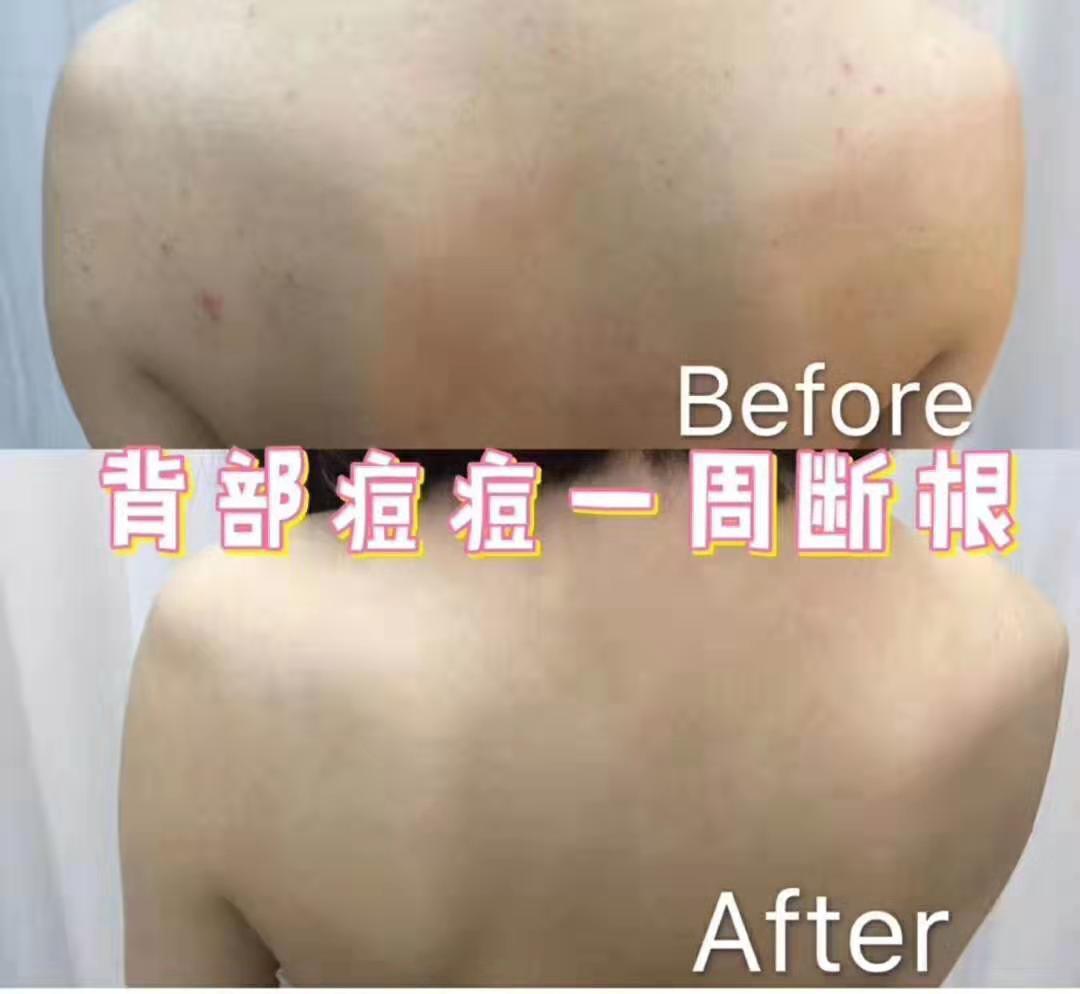 现在可以买哪些品牌的护肤品,100块钱能买最多护肤品